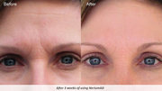 The Nerium Experience and Opportunity!!!