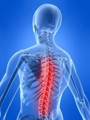 Spine Surgery Frisco